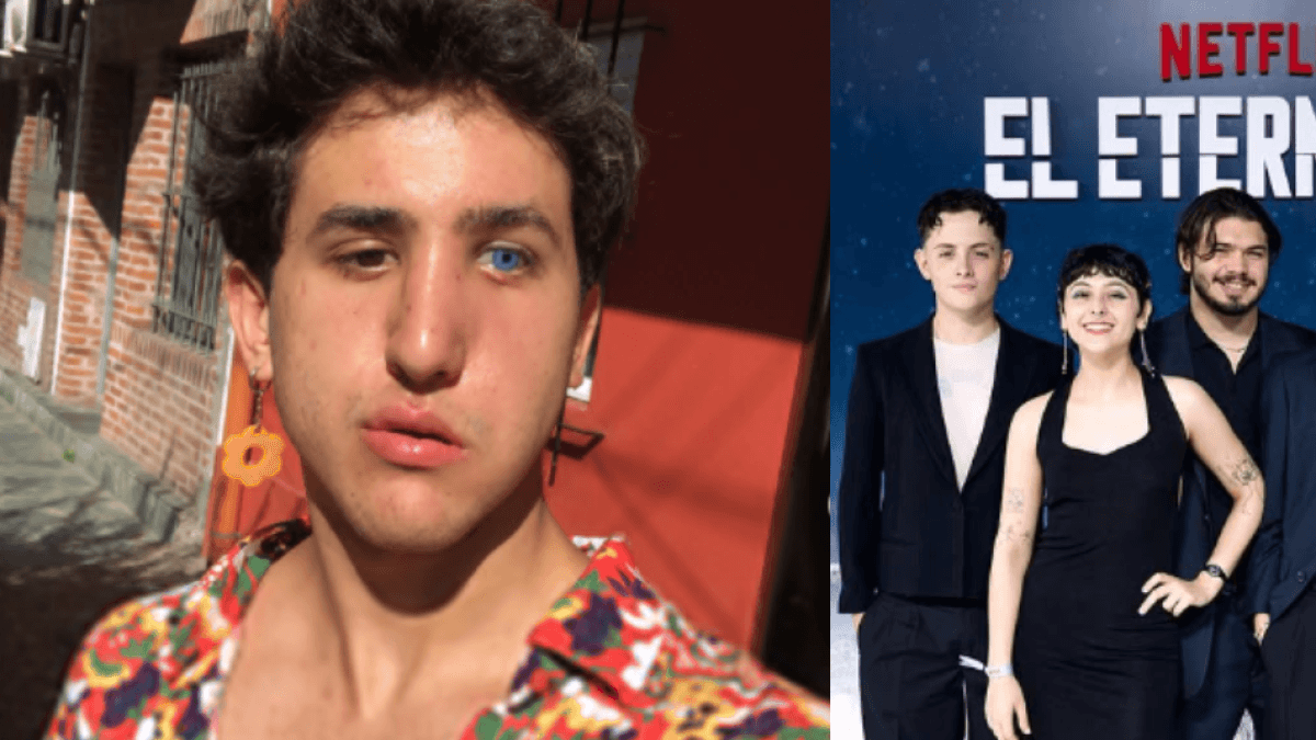 Актер популярного сериала Netflix «Вечная» провел 21 день в коме и получил паралич лица.
